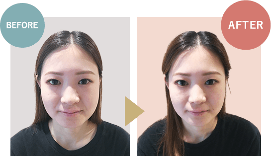 ビフォーアフター02