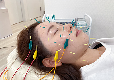 ヒト幹細胞培養液を使用するコース